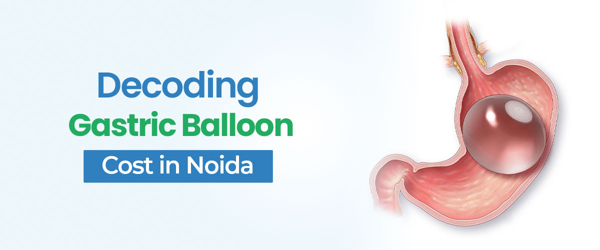 Decoding The Gastric Balloon Surgery Cost In Noida