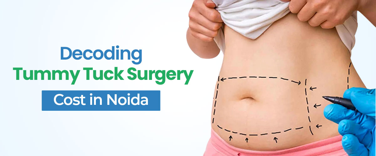 Decoding Tummy Tuck Surgery Cost in Noida