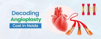 Angioplasty Cost in Noida