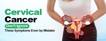 Cervical Cancer