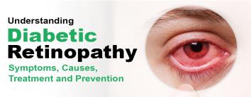 Diabetic Retinopathy