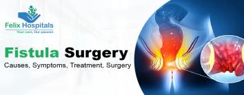 FISTULA SURGERY : CAUSES, SYMPTOMS, TREATMENT, SURGERY