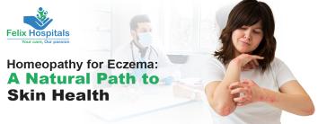 Homeopathy for Eczema